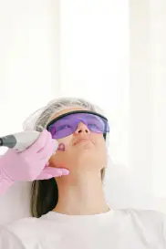 Laser Scar Removal Treatment