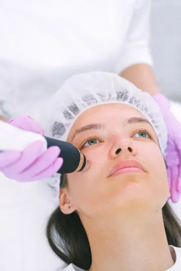 Our Multi-depth Fractional Acne Treatment Process