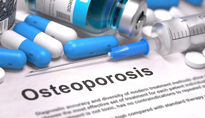 Best Medications for Osteoporosis